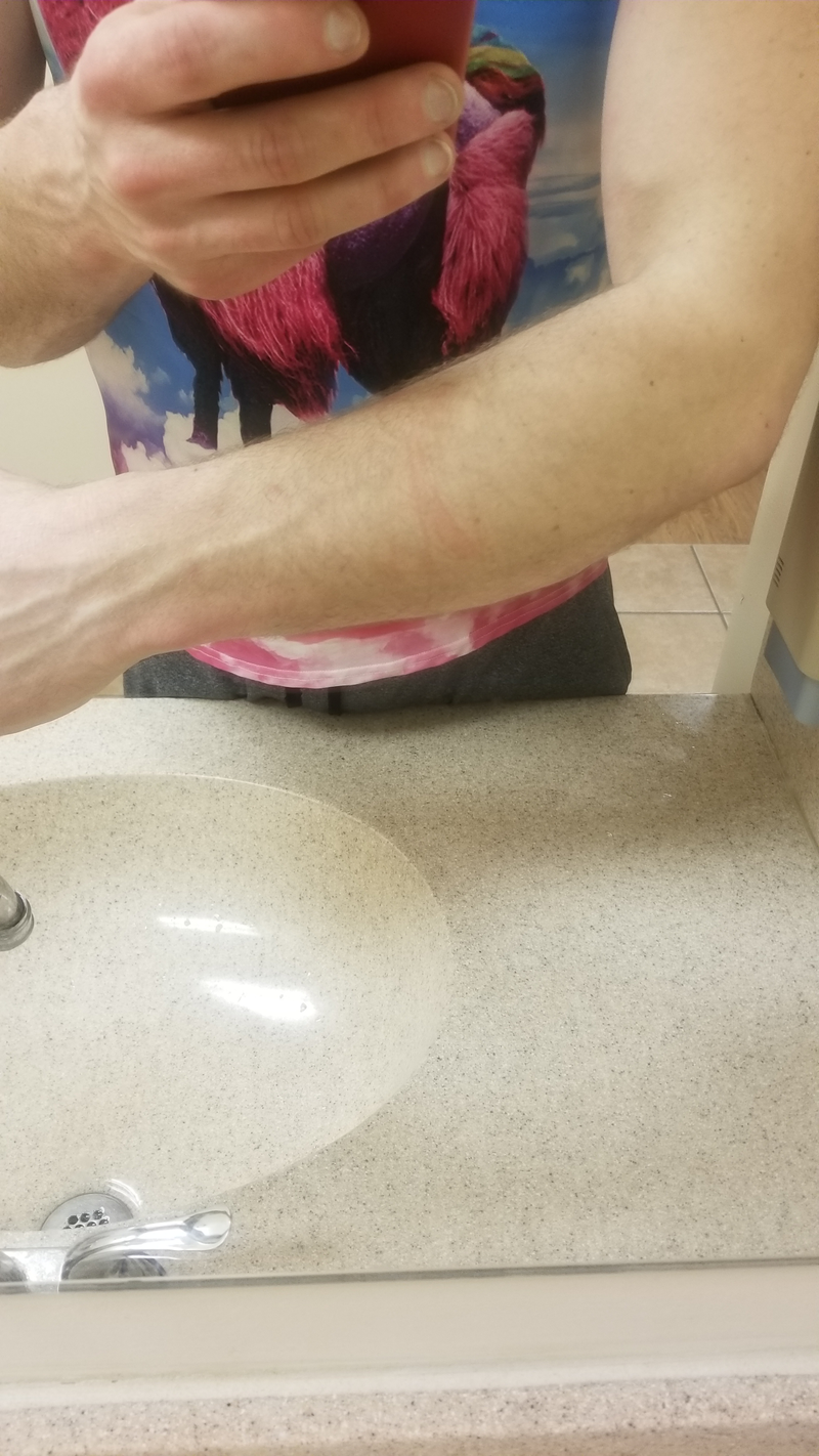 You can’t see it to well but yeah, my arm is pretty scraped. Luckily not bleeding but that’s from years of scraping the hell out of them.